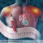 Gene’s Mutation Crucial For Human Development Related To Arrhythmia